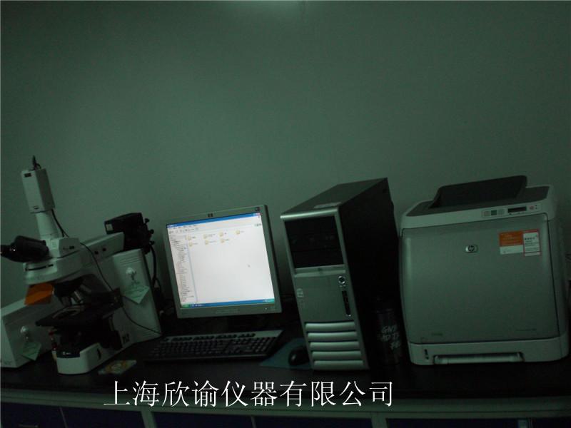 [欄目置頂]染色體分析系統(tǒng)（XY-RS-A2）、高配核型分析系統(tǒng)